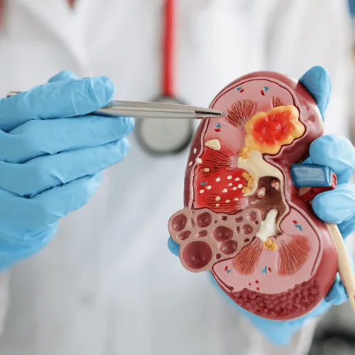 ¿Qué especialista trata la infección urinaria en CDMX?